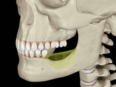 Residual Ridge Resorption: The Unstoppable Phenomenon