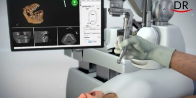 Implant robot performed more than 1000 operations in 2019