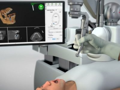 Implant robot performed more than 1000 operations in 2019