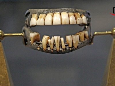 Dental denture history