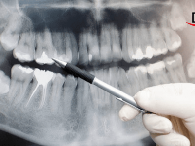 Oral Medicine & Radiology – An Undervalued Specialty Of Dentistry