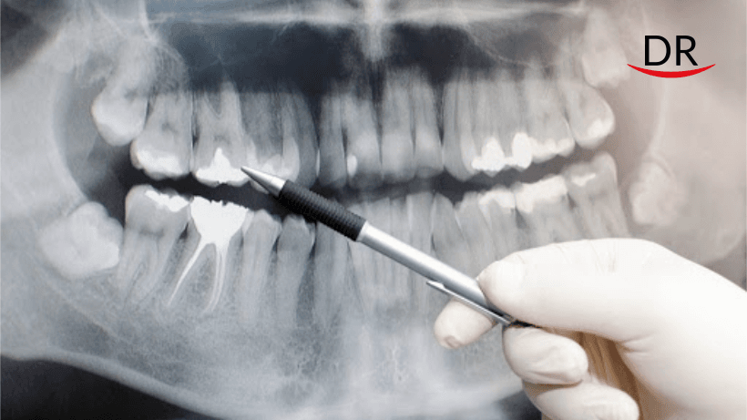 Oral Medicine & Radiology – An Undervalued Specialty Of Dentistry