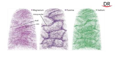 New Data on the Structure of Human Tooth Enamel