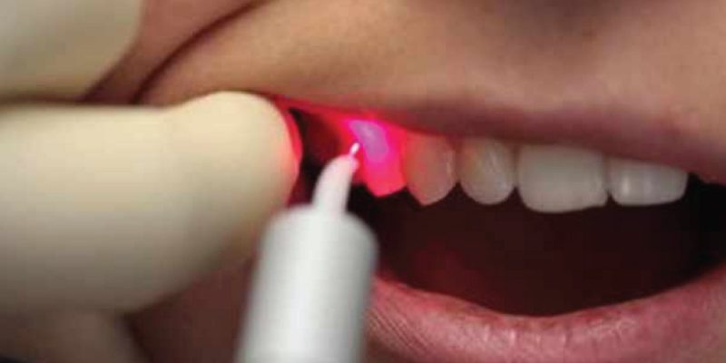 Laser Medicine & Modern Dentistry