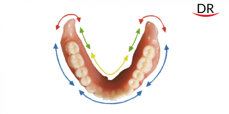 Suction Effective Mandibular Complete Denture (SEM-CD) - An Overview