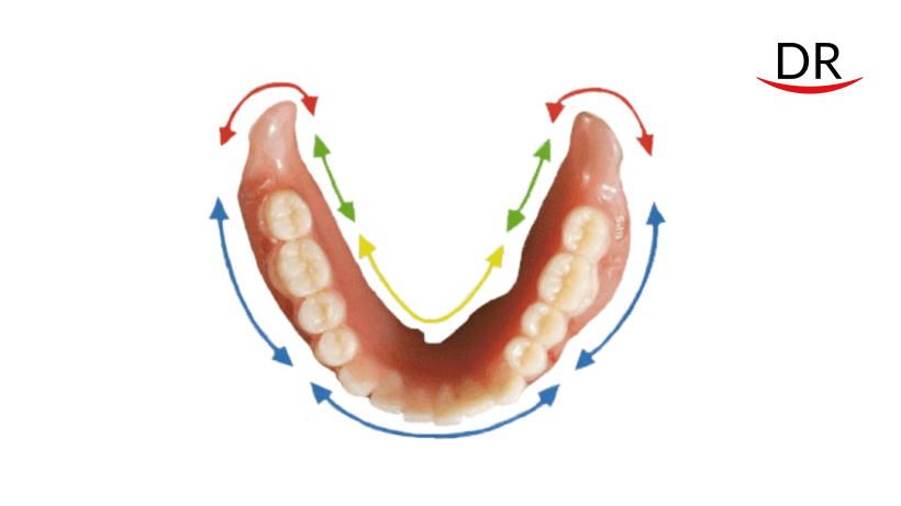 Suction Effective Mandibular Complete Denture (SEM-CD) - An Overview