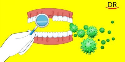 Tooth loss without bleeding- An emerging complaint of Covid-19 patients.