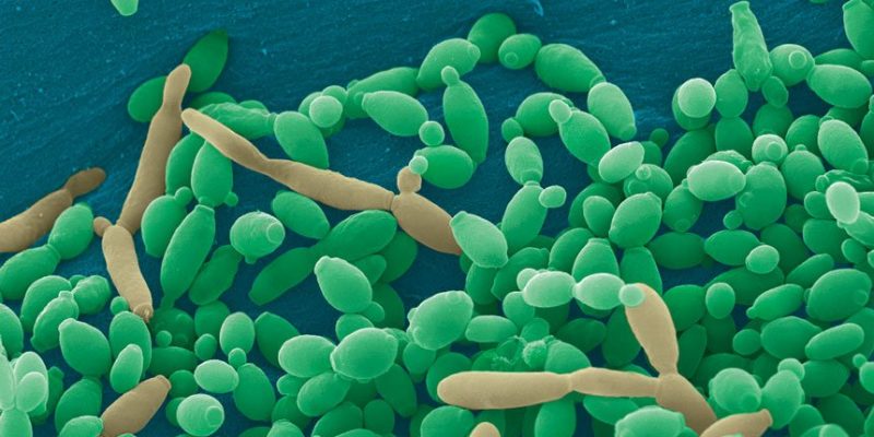 How Periodontitis Bacteria Borrow Growth Molecules From Their Neighbors?