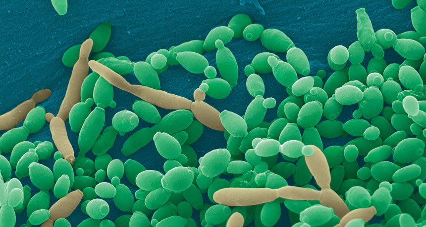 How Periodontitis Bacteria Borrow Growth Molecules From Their Neighbors?