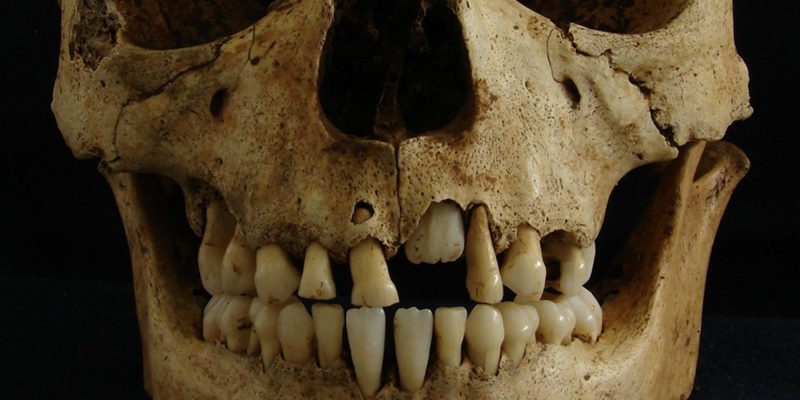 Paleogenomics: How teeth told the history of epidemics!