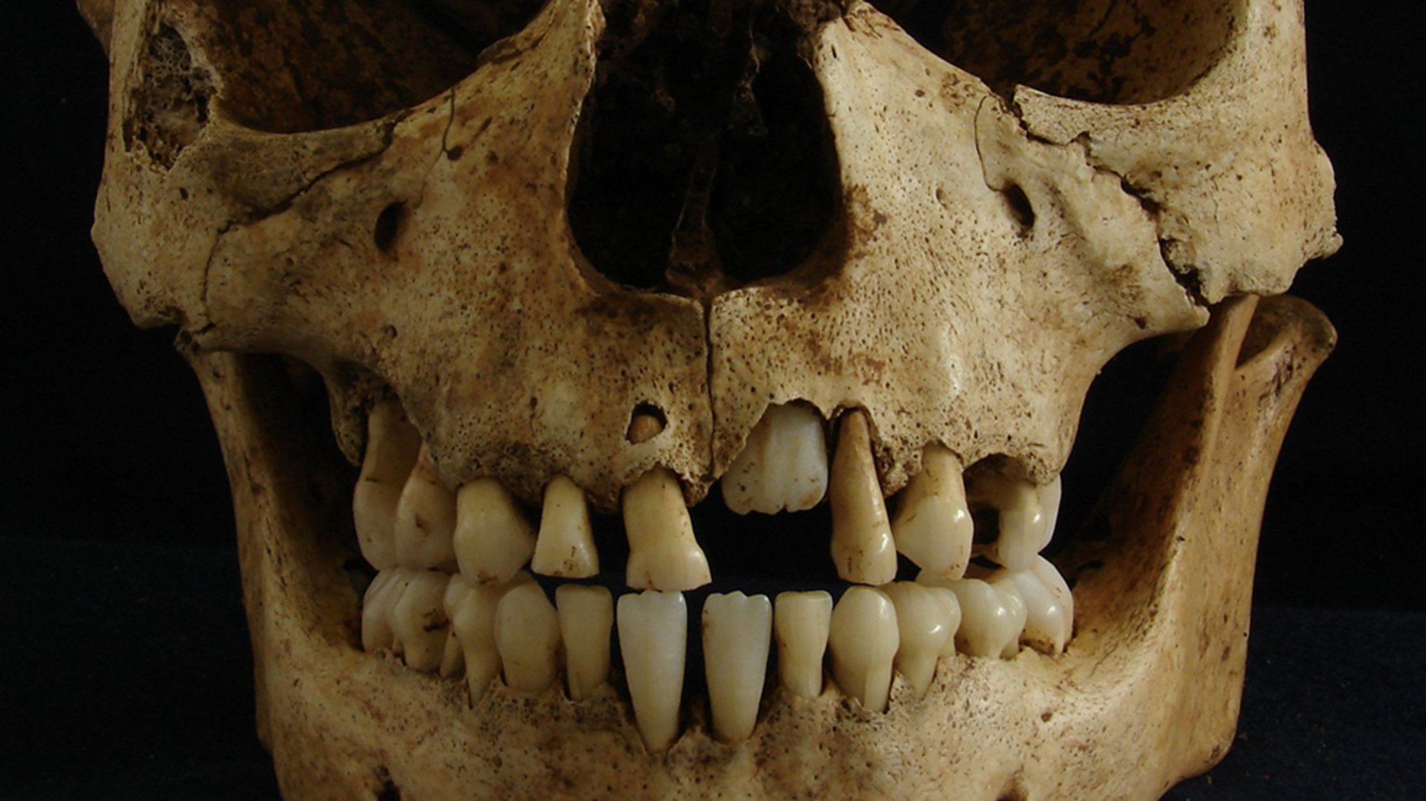 Paleogenomics: How teeth told the history of epidemics!