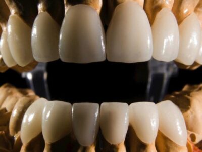 A Stronger And More Durable Enamel: Dentistry and Beyond.