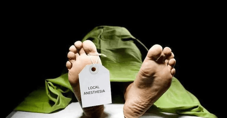 Death due to local anesthesia : A rare complication cover