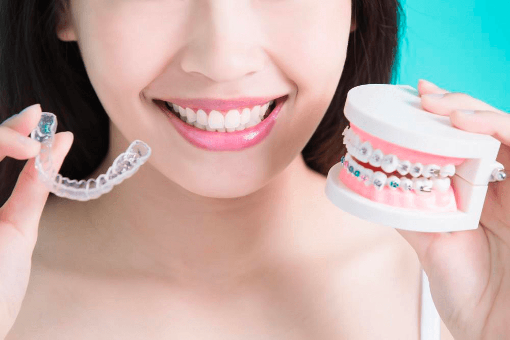 Are Clear Aligners Better than the Conventional Orthodontic Treatment? cover