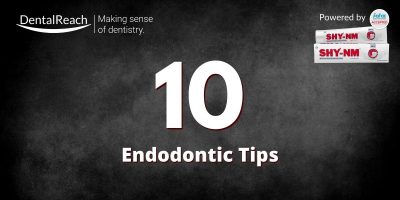 10 Endodontic Tips for a Fresher Dentist cover