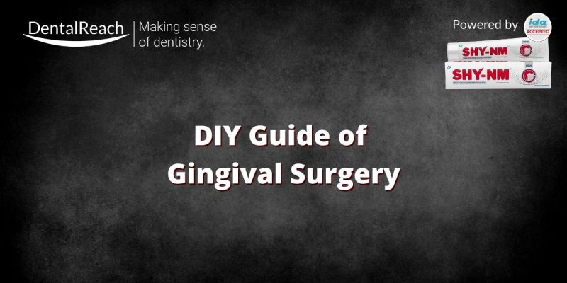 DIY Guide of Gingival Surgery for a Fresher Dentist cover
