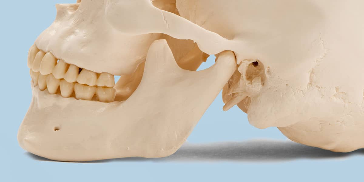 Platelet-Wealthy Plasma Presentations Promising Effects In Treating Temporomandibular Joint Osteoarthritis | DentalReach – Main Dental Mag