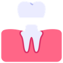 Dental crowns