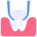 Extraction