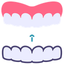 Invisible braces