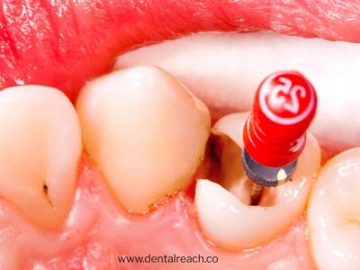 dr blog8