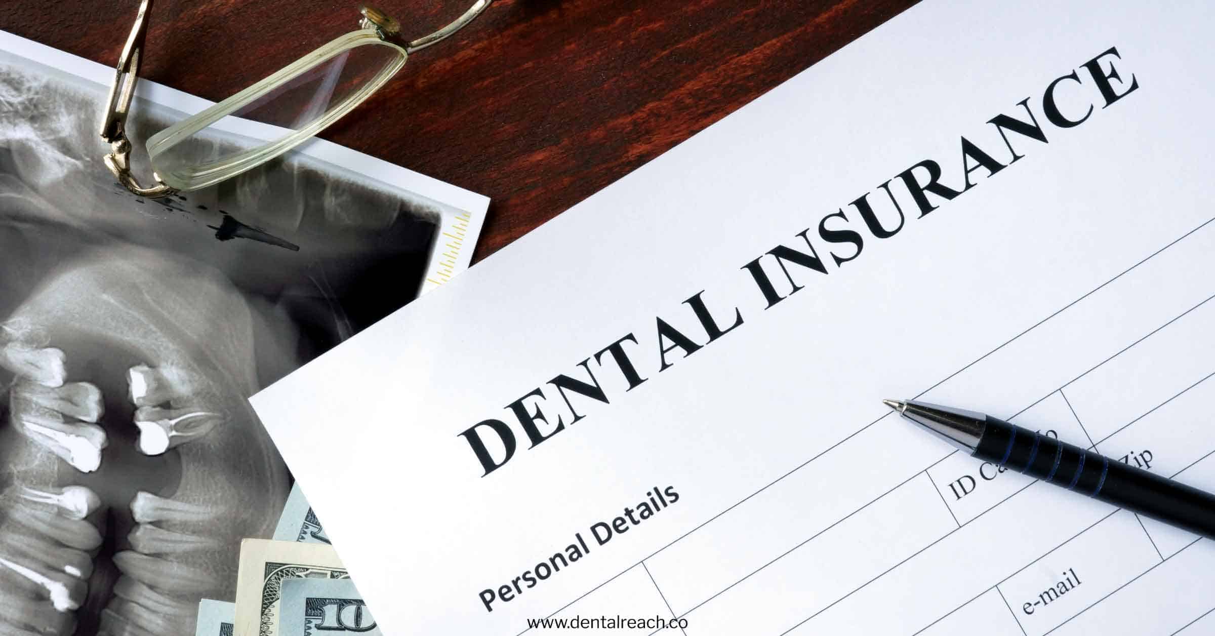 Dental Insurance In India: Tooth Matters - DentalReach - Leading Dental Magazine - Dentistry Journal, News & Events