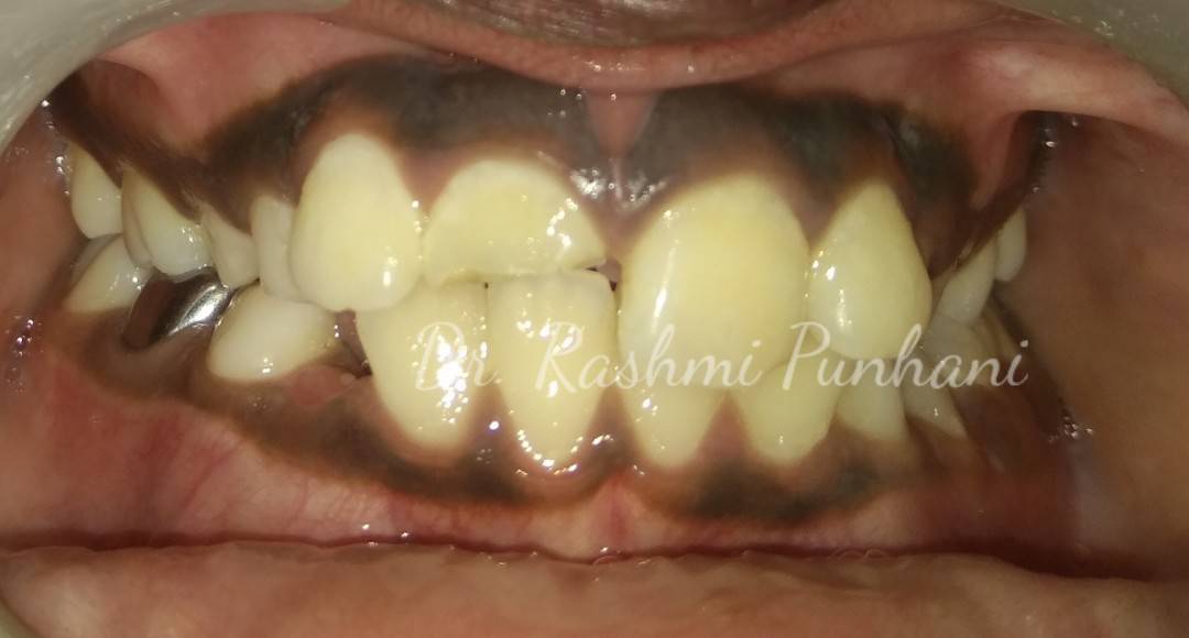 International Journal Of Advanced Academic Research