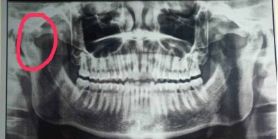 Blog11 min