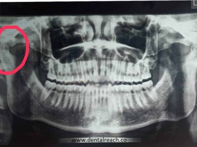 Blog11 min