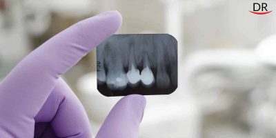 Blog3 a72b27db1f695458548f85bdcd5d7250 2000