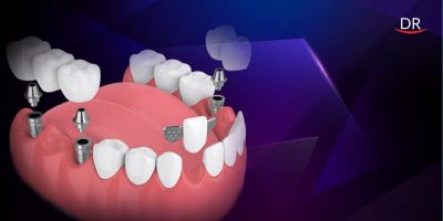 Blog 7 6d016235b6e49eeb1fe314db56c14fed 2000