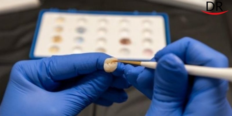 Dental lab market