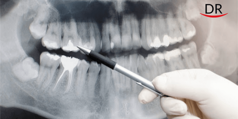 Oral Medicine & Radiology – An Undervalued Specialty Of Dentistry