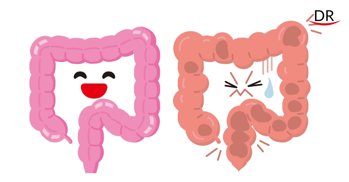 Could the Cure for IBD be Inside your Mouth?