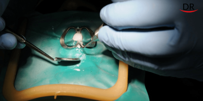 Benefits of Rubber Dam Isolation in COVID 19 Era