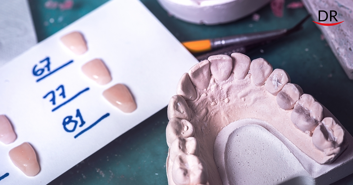 Cementation - Clinical Tips & Tricks
