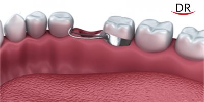 The Adolescent and Functional Space