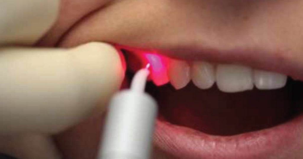 Laser Medicine & Modern Dentistry