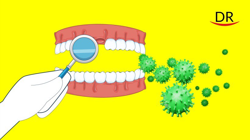 Tooth loss without bleeding- An emerging complaint of Covid-19 patients.