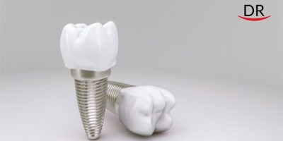 New Implant Coating Will Prevent Inflammation