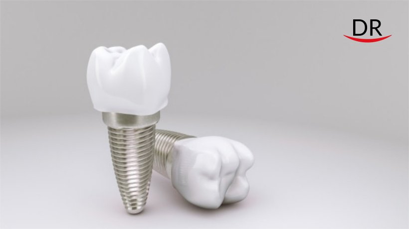 New Implant Coating Will Prevent Inflammation