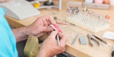 Dental Technicians - The Unsung Heroes!