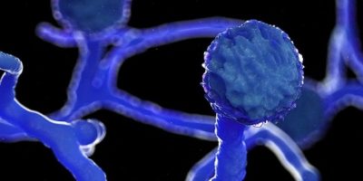 Covid -19 associated Mucormycosis [CAM]