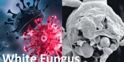 ‘White Fungus’ - All you need to know