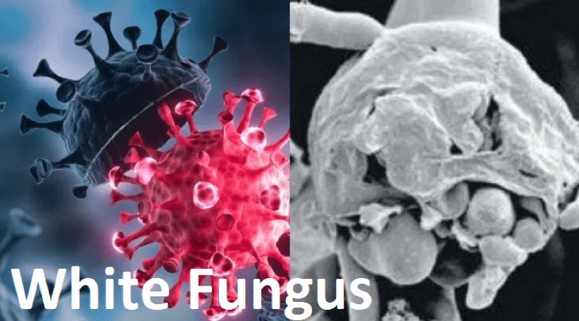 ‘White Fungus’ - All you need to know
