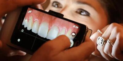 How to use your Mobile Phone for Dental Photography?