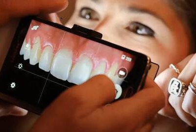 How to use your Mobile Phone for Dental Photography?