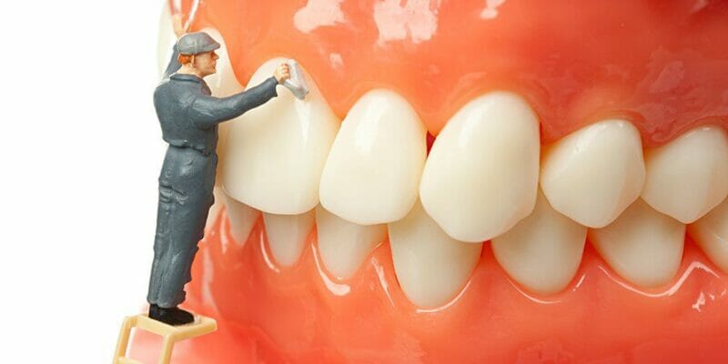 Cleaning your “plastic beauty” : Patient checklist for cleaning dental prosthesis