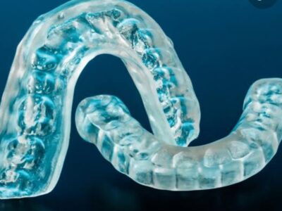 Treatment Of Tinnitus Due To TMJ Disorders By Dental Surgeons