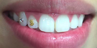 The Role of Fashion in Aesthetic Dentistry